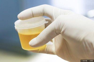 排尿很黃、異味很大？身體在向你暗示這4件事，可能和疾病有關(guān)