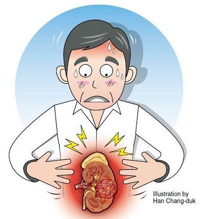 58歲男子腎癌晚期，回家天天喝酒打牌，誰勸都沒用：不想治了
